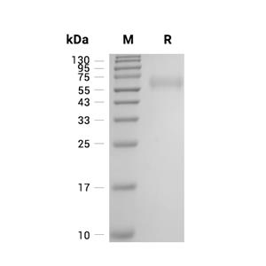 Cathepsin C/DPPI蛋白, Human (HEK293, C-His)