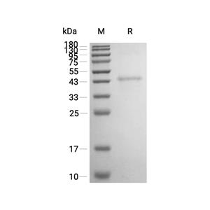 CCN1/Cyr61蛋白, Mouse (His)