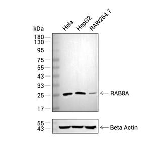 RAB8A抗体 (YA109)