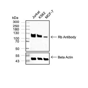 Rb抗体 (YA104)