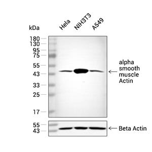 alpha smooth muscle Actin抗体 (YA627)