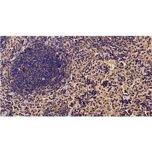 SQSTM1/p62抗体 (YA669)