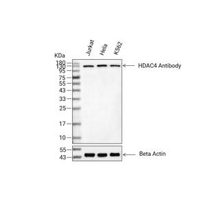HDAC4抗体 (YA741),HDAC4 Antibody (YA741)