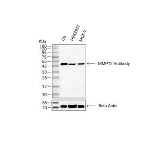 MMP12抗体 (YA288)