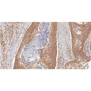 Phospho-mTOR (Ser2448)抗体 (YA171),Phospho-mTOR (Ser2448) Antibody (YA171)