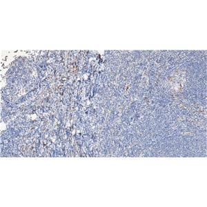 Phospho-STAT1 (Tyr701)抗体,Phospho-STAT1 (Tyr701) Antibody