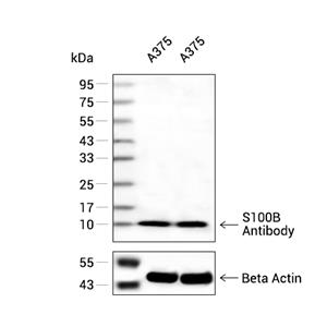 S100B抗体