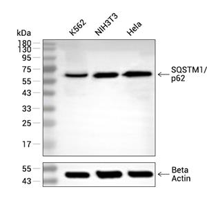SQSTM1/p62抗体 (YA062),SQSTM1/p62 Antibody (YA062)