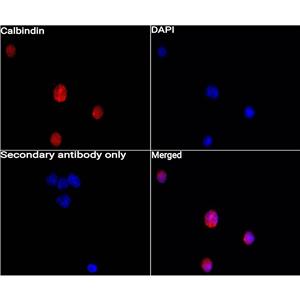 Calbindin抗体 (YA574)