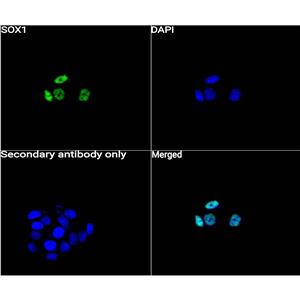 SOX1抗体 (YA070),SOX1 Antibody (YA070)