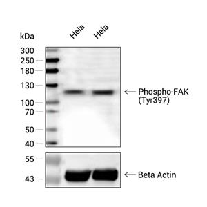 Phospho-FAK (Tyr397)抗体 (YA198),Phospho-FAK (Tyr397) Antibody (YA198)
