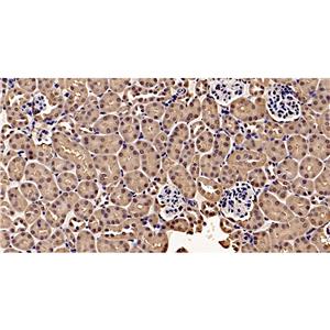 Phospho-JAK2 (Tyr1007+Tyr1008)抗体 (YA181)