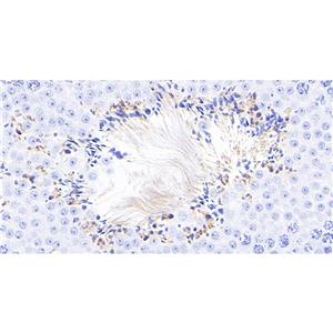 Phospho-p95/NBS1 (Ser343)抗体 (YA165)