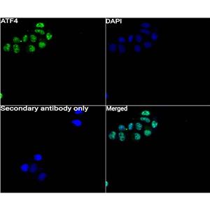 ATF4抗体 (YA605),ATF4 Antibody (YA605)