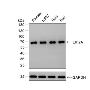 EIF2A抗体 (YA465),EIF2A Antibody (YA465)