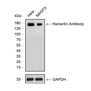 Hamartin抗体 (YA743)