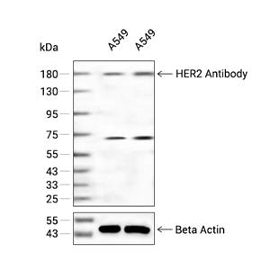 C-erbB-2/HER2抗体 (YA388)