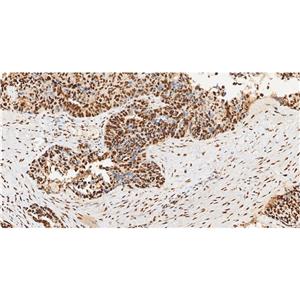 HP1 gamma抗体 (YA733)