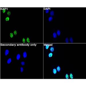 KAP1抗体 (YA3523)