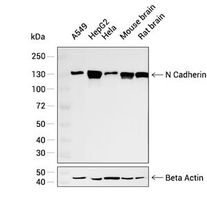 N Cadherin抗体 (YA276)