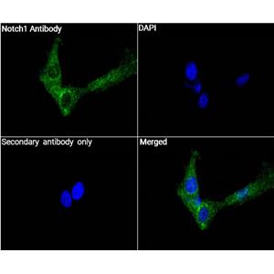 Notch1抗体