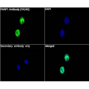 PARP1抗体 (YA245)