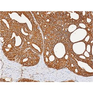 Peroxiredoxin 1抗体 (YA692)