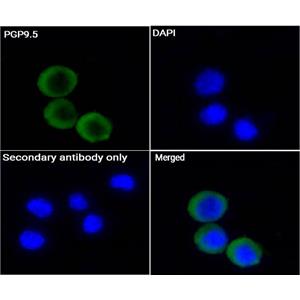 PGP9.5抗体 (YA231)