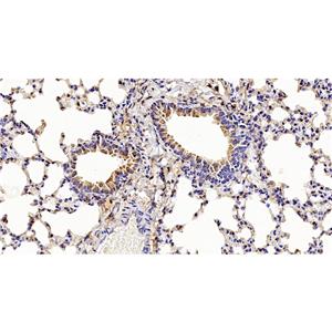 Phospho-eIF4EBP1 (Thr46)抗体 (YA230)