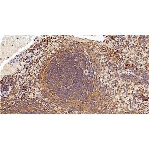 Phospho-NF-KB p65 (Thr254)抗体,Phospho-NF-KB p65 (Thr254) Antibody