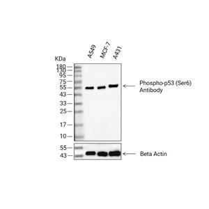 Phospho-p53 (Ser6)抗体 (YA166)