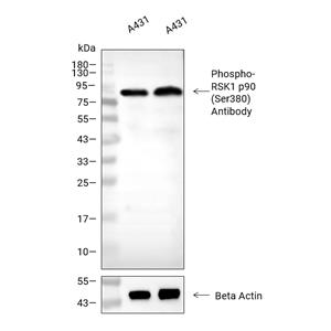 Phospho-RSK1 p90 (Ser380)抗体 (YA158)