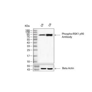 Phospho-RSK1 p90 (Thr359/Ser363)抗体 (YA157),Phospho-RSK1 p90 (Thr359/Ser363) Antibody (YA157)