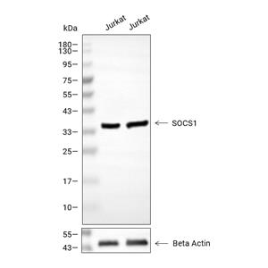 SOCS-1抗体,SOCS-1 Antibody