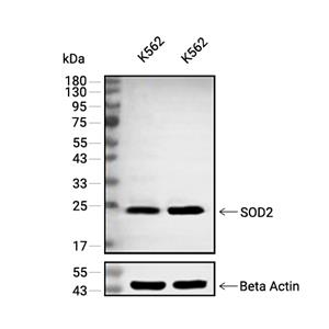 SOD2抗体 (YA670)