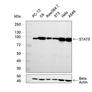 STAT5a+b抗体 (YA054)