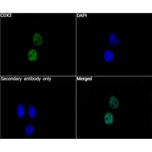 CDX2抗体 (YA3498)