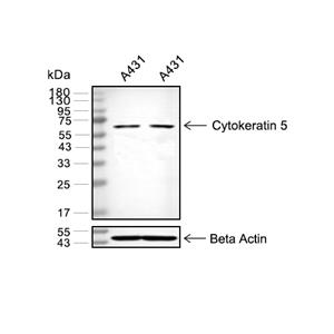 Cytokeratin 5抗体 (YA3509),Cytokeratin 5 Antibody (YA3509)