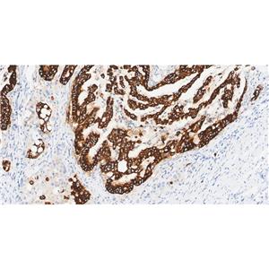 Mucin 5AC抗体 (YA3524)