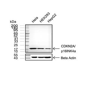 CDKN2A/p16INK4a抗体 (YA3494)