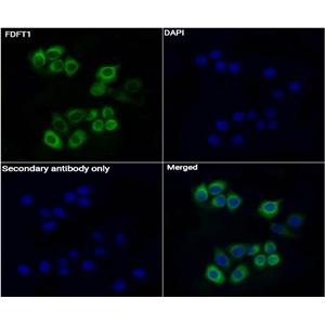 FDFT1抗体 (YA3512)