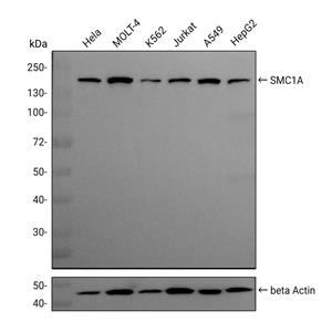 SMC1A抗体 (YA673),SMC1A Antibody (YA673)
