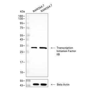 Transcription Initiation Factor IIB抗体 (YA1055)