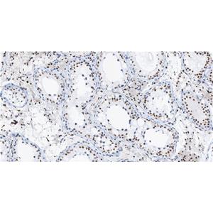 Baf180抗体 (YA1176),Baf180 Antibody (YA1176)