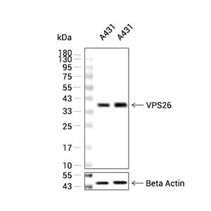 VPS26抗体 (YA1546)