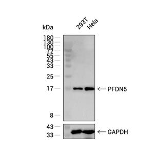 PFDN5抗体 (YA1717)