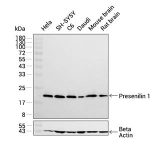 Presenilin 1抗体 (YA1722)