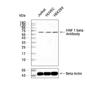 HNF 1 beta抗体 (YA1724)