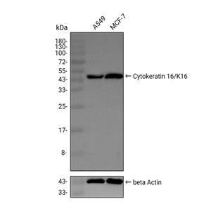 Cytokeratin 16抗体 (YA948),Cytokeratin 16 Antibody (YA948)