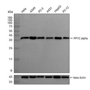 PP1C alpha抗体 (YA1040)